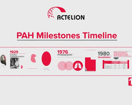 Animated Timeline Video