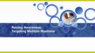 James Berenson MD KOL Video California - Multiple Myeloma